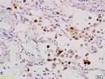 ELK1 Antibody in Immunohistochemistry (Paraffin) (IHC (P))