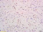 SRF Antibody in Immunohistochemistry (Paraffin) (IHC (P))