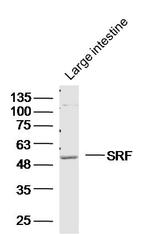 SRF Antibody in Western Blot (WB)