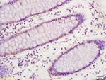 SREBP-1/2 Antibody in Immunohistochemistry (Paraffin) (IHC (P))