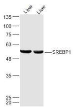 SREBP-1/2 Antibody in Western Blot (WB)