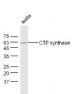 CTP synthase 1 Antibody in Western Blot (WB)