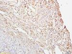 CTBP1 Antibody in Immunohistochemistry (Paraffin) (IHC (P))