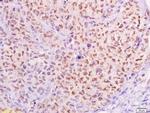 MTA1 Antibody in Immunohistochemistry (Paraffin) (IHC (P))