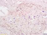 MTA1 Antibody in Immunohistochemistry (Paraffin) (IHC (P))