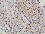 MTA1 Antibody in Immunohistochemistry (Paraffin) (IHC (P))