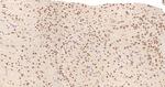 MTA1 Antibody in Immunohistochemistry (Paraffin) (IHC (P))