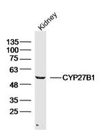 CYP27B1 Antibody in Western Blot (WB)