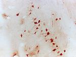 NFAT2 Antibody in Immunohistochemistry (Paraffin) (IHC (P))