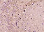 NFAT2 Antibody in Immunohistochemistry (Paraffin) (IHC (P))