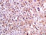 MC-1R/MC1 Receptor Antibody in Immunohistochemistry (Paraffin) (IHC (P))