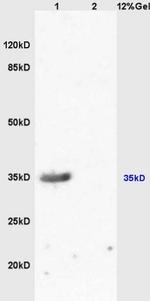 MC-1R/MC1 Receptor Antibody in Western Blot (WB)