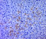 RPS6KB1 Antibody in Immunohistochemistry (Paraffin) (IHC (P))