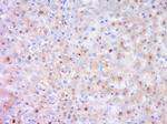 DENND4B Antibody in Immunohistochemistry (Paraffin) (IHC (P))