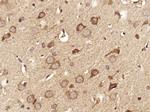 DGKZ Antibody in Immunohistochemistry (Paraffin) (IHC (P))