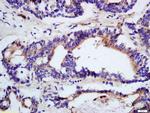 DHDH Antibody in Immunohistochemistry (Paraffin) (IHC (P))