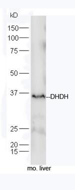 DHDH Antibody in Western Blot (WB)