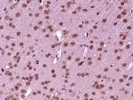 DHX33 Antibody in Immunohistochemistry (Paraffin) (IHC (P))