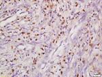 DHX8 Antibody in Immunohistochemistry (Paraffin) (IHC (P))