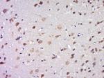 DPAGT1 Antibody in Immunohistochemistry (Paraffin) (IHC (P))