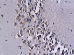 CXCL16 Antibody in Immunohistochemistry (Paraffin) (IHC (P))