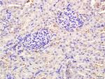 TLR3 Antibody in Immunohistochemistry (Paraffin) (IHC (P))