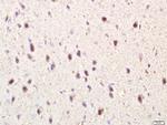 TLR3 Antibody in Immunohistochemistry (Paraffin) (IHC (P))