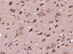 EDEM3 Antibody in Immunohistochemistry (Paraffin) (IHC (P))