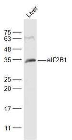 eIF2B1 Antibody in Western Blot (WB)