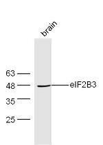 EIF2B3 Antibody in Western Blot (WB)