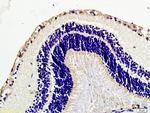 Caveolin-1 Antibody in Immunohistochemistry (Paraffin) (IHC (P))