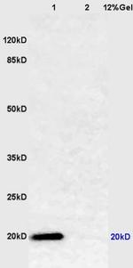 Caveolin-1 Antibody in Western Blot (WB)