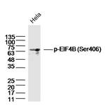 Phospho-EIF4B (Ser406) Antibody in Western Blot (WB)