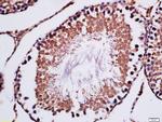 ELAC1 Antibody in Immunohistochemistry (Paraffin) (IHC (P))