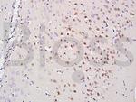 A2AR/Adenosine A2a receptor Antibody in Immunohistochemistry (Paraffin) (IHC (P))