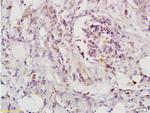 LIFR/CD118 Antibody in Immunohistochemistry (Paraffin) (IHC (P))