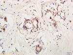 LIFR/CD118 Antibody in Immunohistochemistry (Paraffin) (IHC (P))