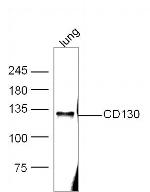 IL-6R Beta/CD130/gp130 Antibody in Western Blot (WB)