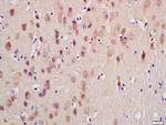 GnRHR Antibody in Immunohistochemistry (Paraffin) (IHC (P))