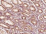 EVPLL Antibody in Immunohistochemistry (Paraffin) (IHC (P))