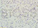 Gremlin 1 Antibody in Immunohistochemistry (Paraffin) (IHC (P))