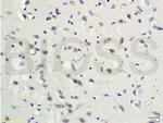 Gremlin 1 Antibody in Immunohistochemistry (Paraffin) (IHC (P))