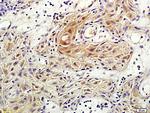 Rho C Antibody in Immunohistochemistry (Paraffin) (IHC (P))