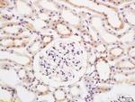 E2AK2/PKR Antibody in Immunohistochemistry (Paraffin) (IHC (P))