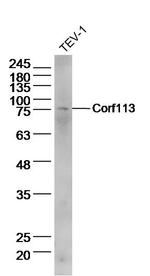 C1orf113 Antibody in Western Blot (WB)