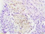 Cathepsin B Heavy Chain Antibody in Immunohistochemistry (Paraffin) (IHC (P))