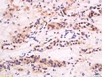 CXCL14 Antibody in Immunohistochemistry (Paraffin) (IHC (P))