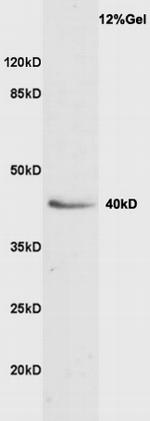 VASH1 Antibody in Western Blot (WB)