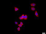 AQP1 Antibody in Immunocytochemistry (ICC/IF)