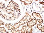 AQP1 Antibody in Immunohistochemistry (Paraffin) (IHC (P))